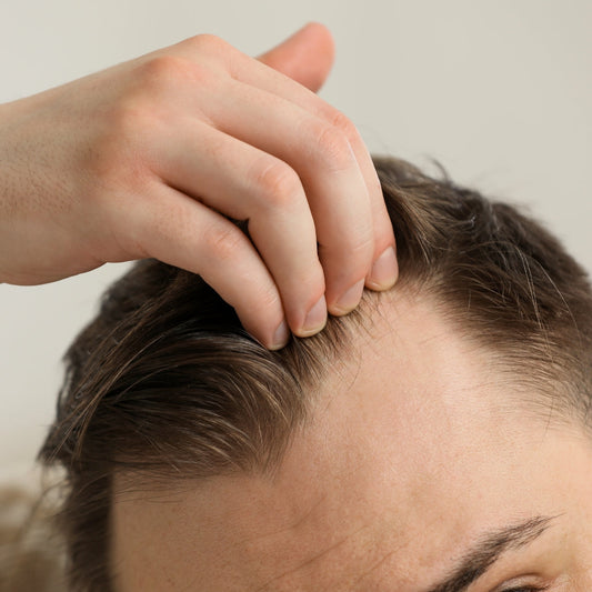 Perte de cheveux ? Voici comment y remédier (même avec moins sur la tête)