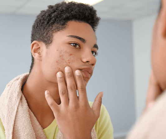 Homme avec acné conseil pour se raser